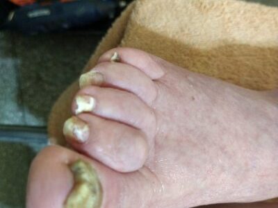 Pedicura Profesional Marcela